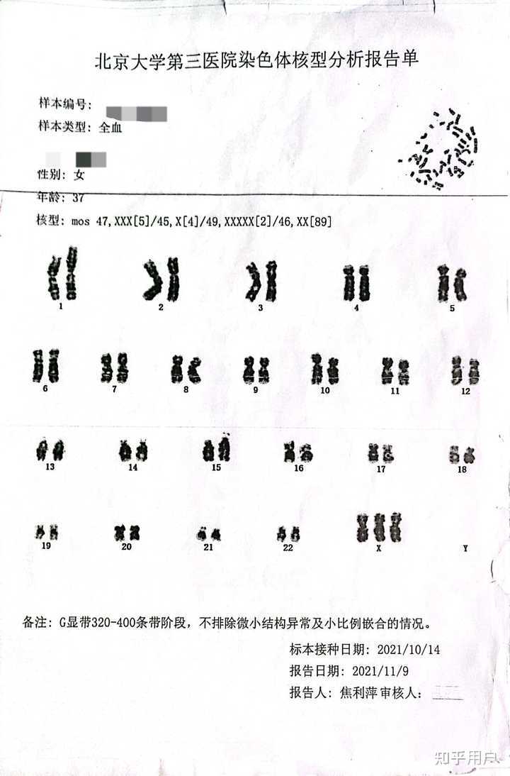 真的存在超雌女性吗?有没有例子?据说是长的比一般女性更美丽,但是可能经期会提前结束,或者影响智力。? - 知乎