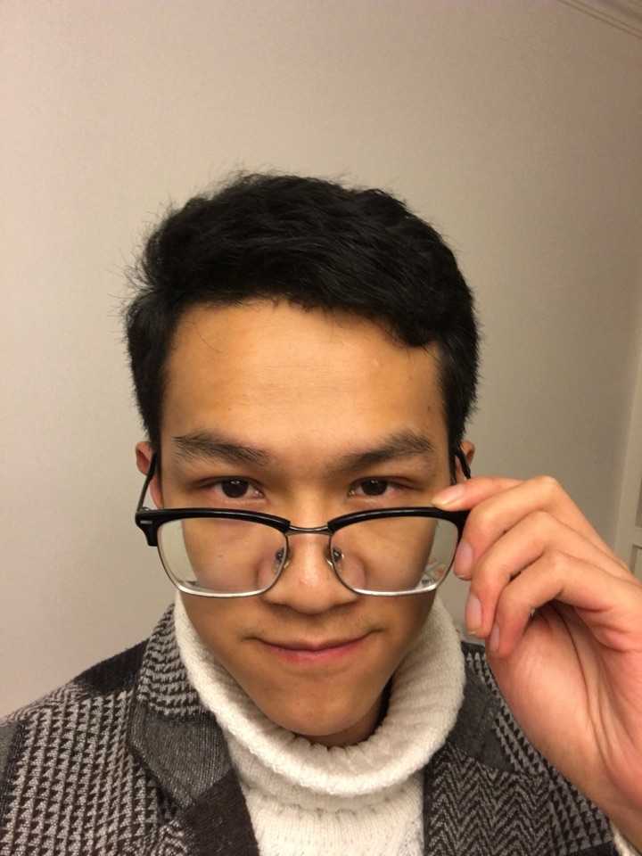 双眼皮的价格_郑大一附院割双眼皮价格_全切双眼皮价格