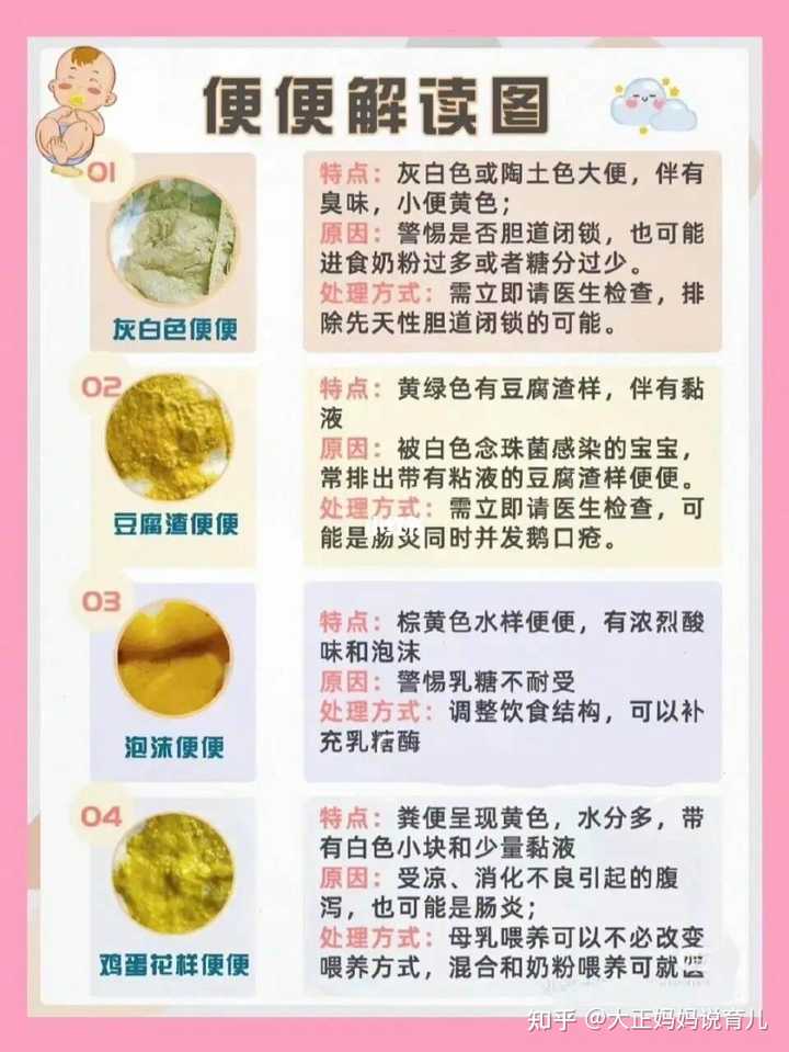 宝宝大便发绿要如何应对？ - 知乎