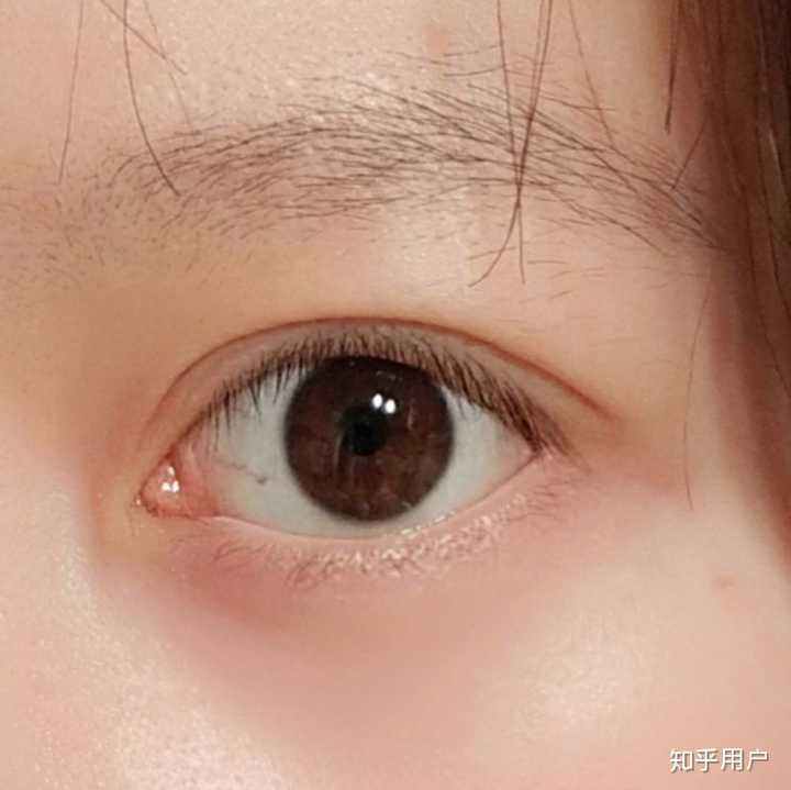 内双和外双的区别是什么?因为有人告诉我,双眼皮的褶皱和眼角有交点就是内双,无论你的双眼皮多宽? - 知乎