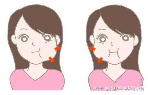 咬肌大跟什么有关系 怎样可以使咬肌变小 知乎