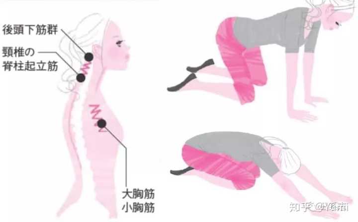 脖子前倾如何解决 知乎