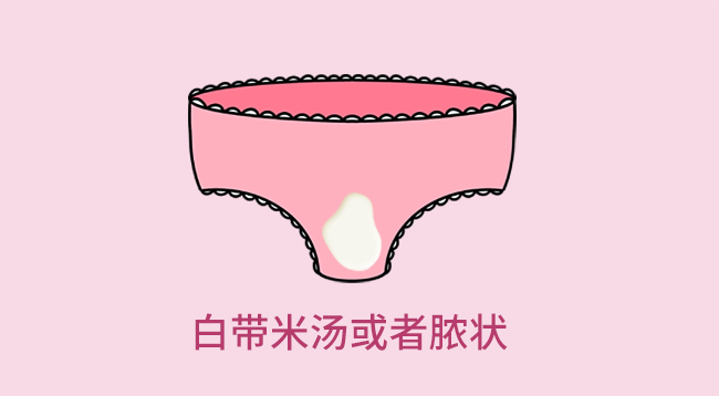 最全[白带异常]自诊指南，你的白带正常吗？ - 知乎