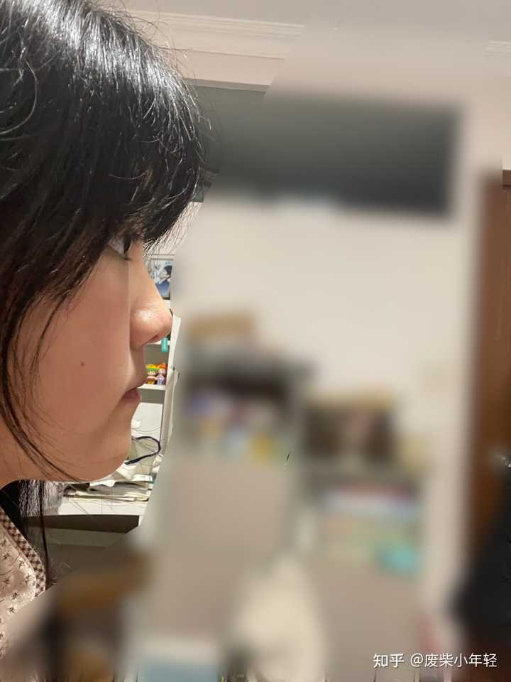 有一个超级扁平的侧脸是一种什么样的体验? - 知乎