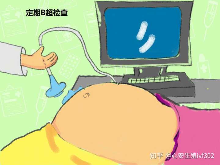 怀孕48天做b超必须空腹吗？