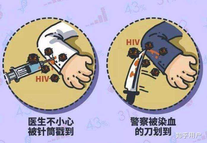 艾滋病血液传播需要什么样的伤口? - 知乎