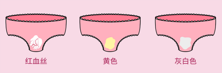 最全[白带异常]自诊指南，你的白带正常吗？ - 知乎
