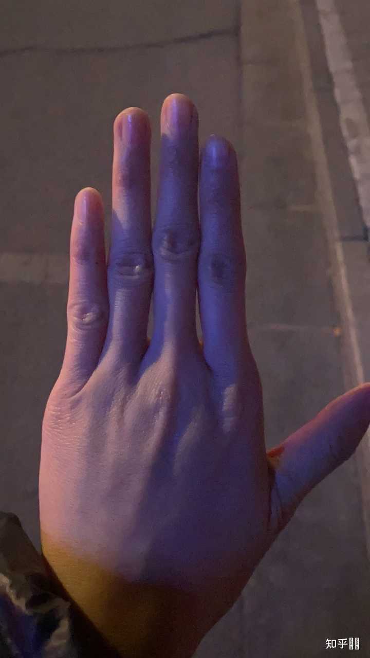 为什么一些女生的无名指明显长于食指。？ 看一些研究，表明这种是典型的男人手掌？ - 知乎
