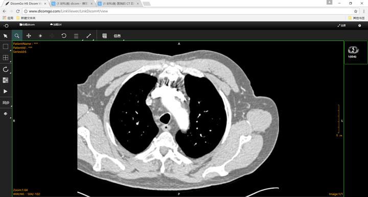医院的 CT 图像是如何生成的，原始图像要使用什么软件查看？ - 知乎