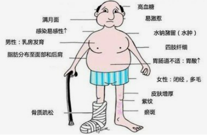 得了库欣综合征的症状有些什么? - 知乎