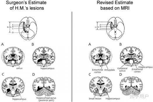 记忆、睡眠、情绪和大脑有什么关系？你认为保养大脑有用吗？