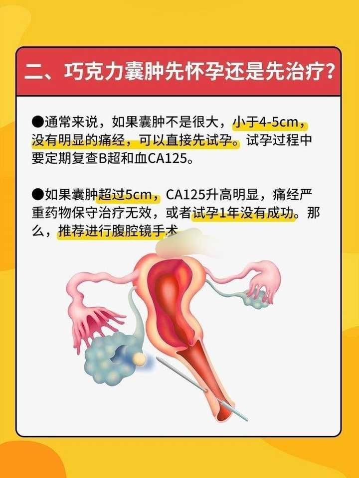 巧克力囊肿怎么治疗最好方法 知乎