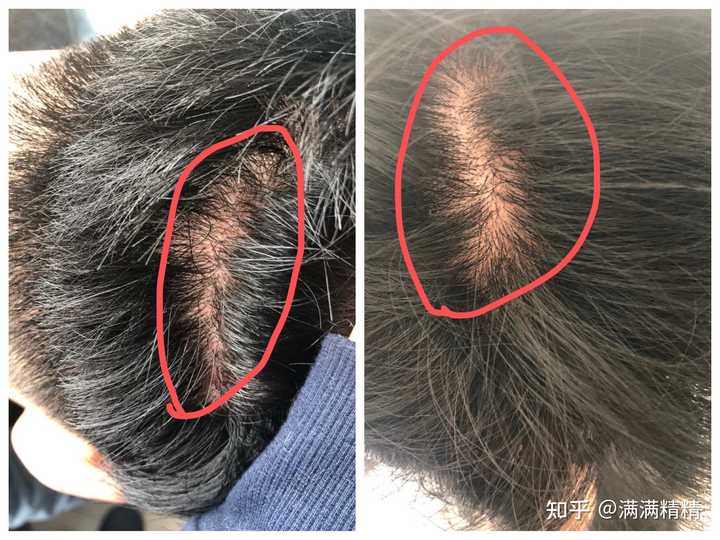 有哪些好用的男士洗发水值得推荐 知乎 有哪些好用的男士洗发水值得推荐 知乎