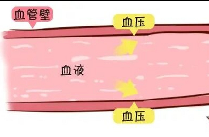 高血压的发生原理是什么? - 知乎