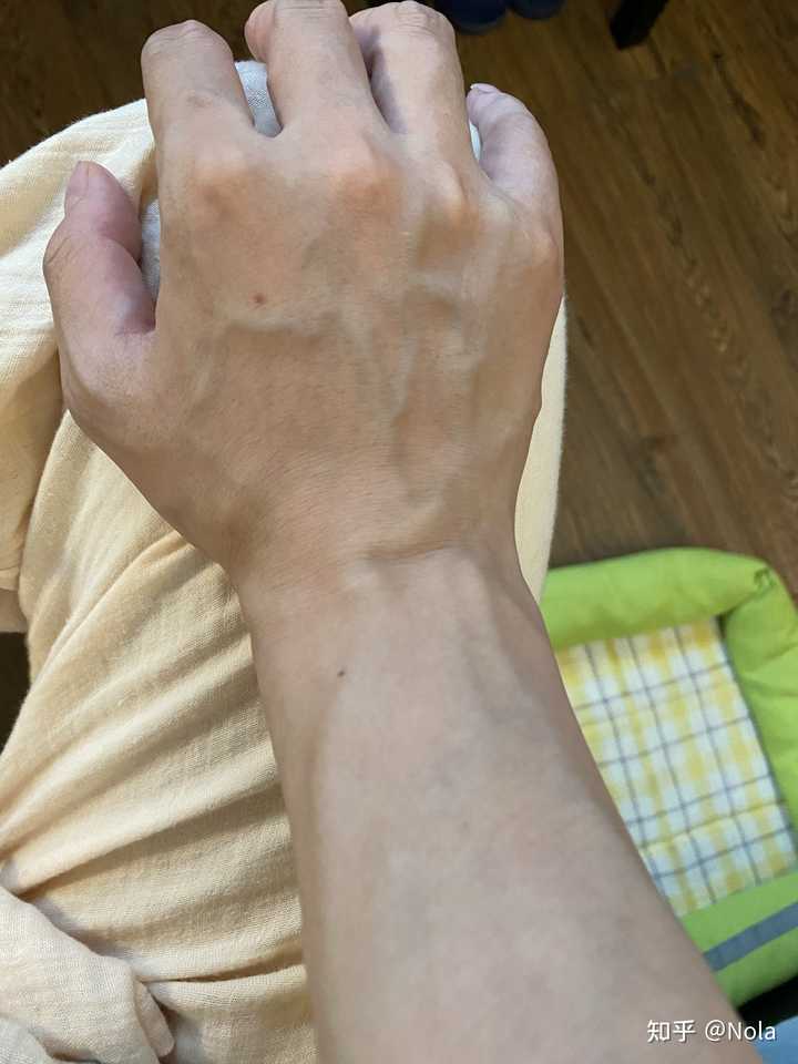 为什么我的手背上静脉血管那么明显 如何改善 知乎 为什么我的手背上静脉血管那么明显 如何改善 知乎