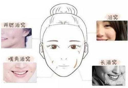 请问各位,我这个是酒窝吗? - 知乎