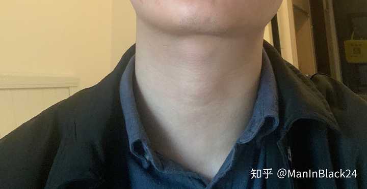 学校体检，查出甲状腺肿大怎么办？