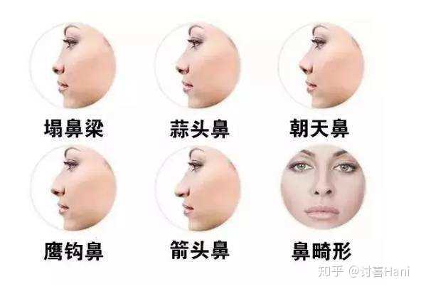 塌鼻梁女生一定不好看吗 知乎 塌鼻梁女生一定不好看吗 知乎