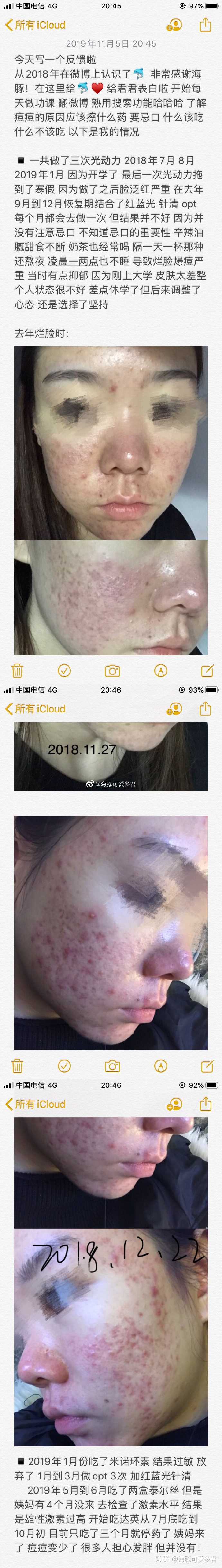 点阵激光术后修复如何保养 海豚可爱多君的回答 知乎