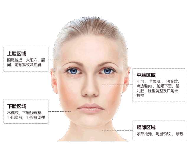 法令纹改善用玻尿酸还是线雕好? - 知乎