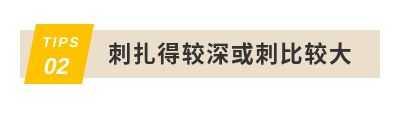 如何科学处理扎入皮肤的毛刺? - 知乎