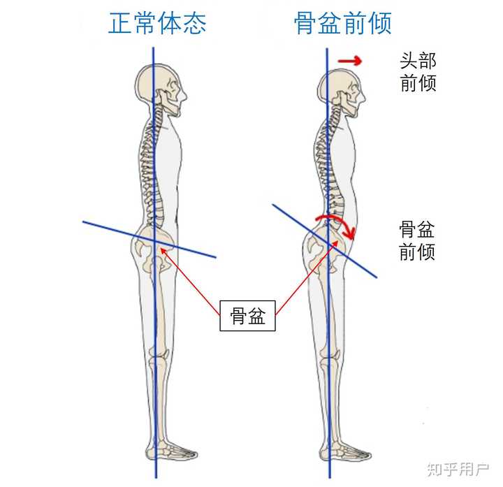 哪种腰垫好一些? - 知乎