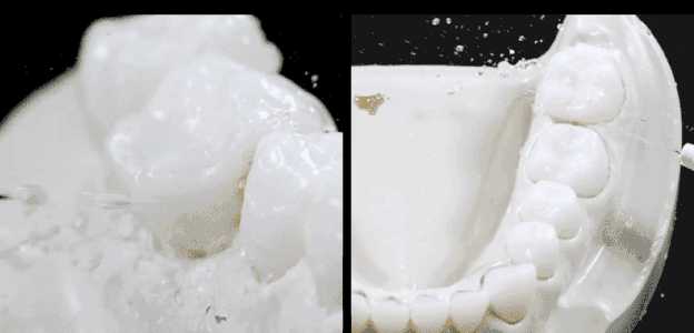 有人用水牙线吗可以每天用吗会不会太频繁对牙龈不好