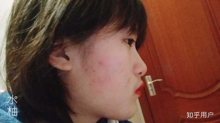 有一个超级扁平的侧脸是一种什么样的体验? - 知乎