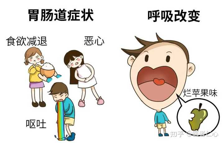 饥饿性酮症有哪些症状? - 知乎