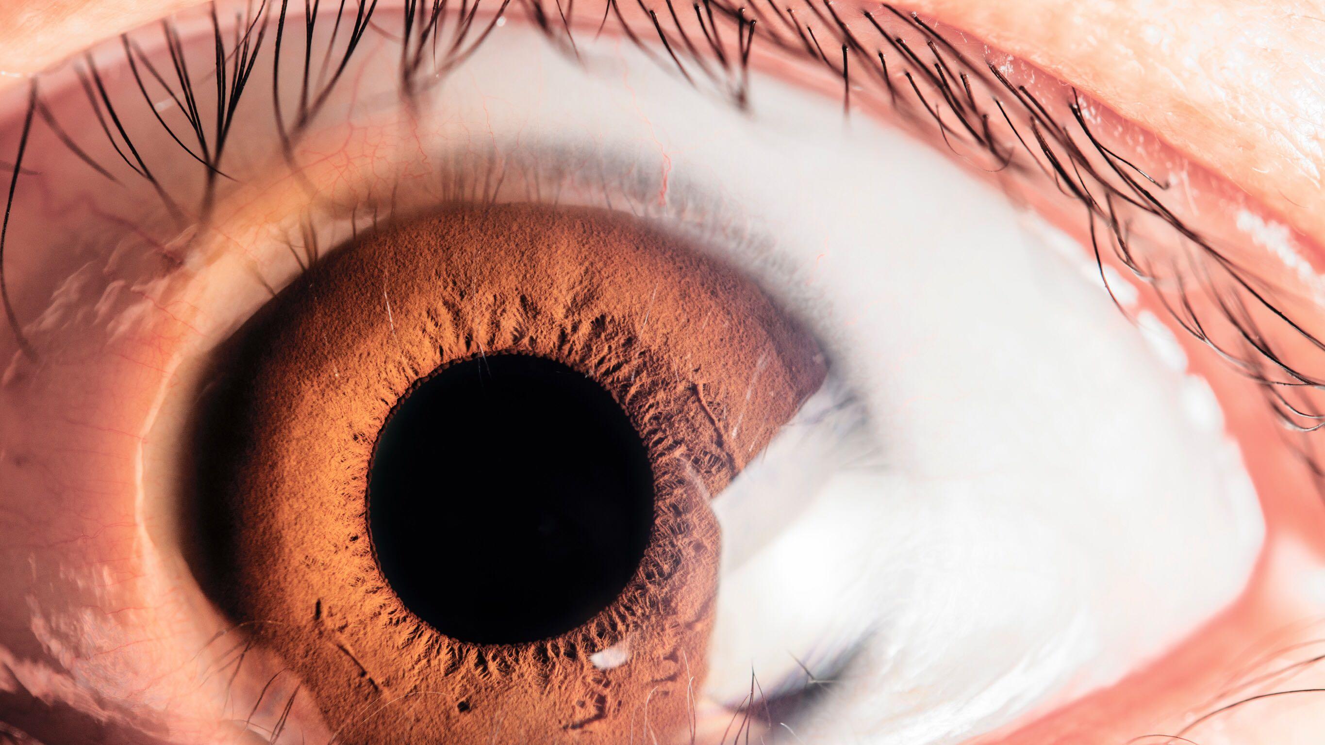 怎么样拍自己的瞳孔? - 知乎