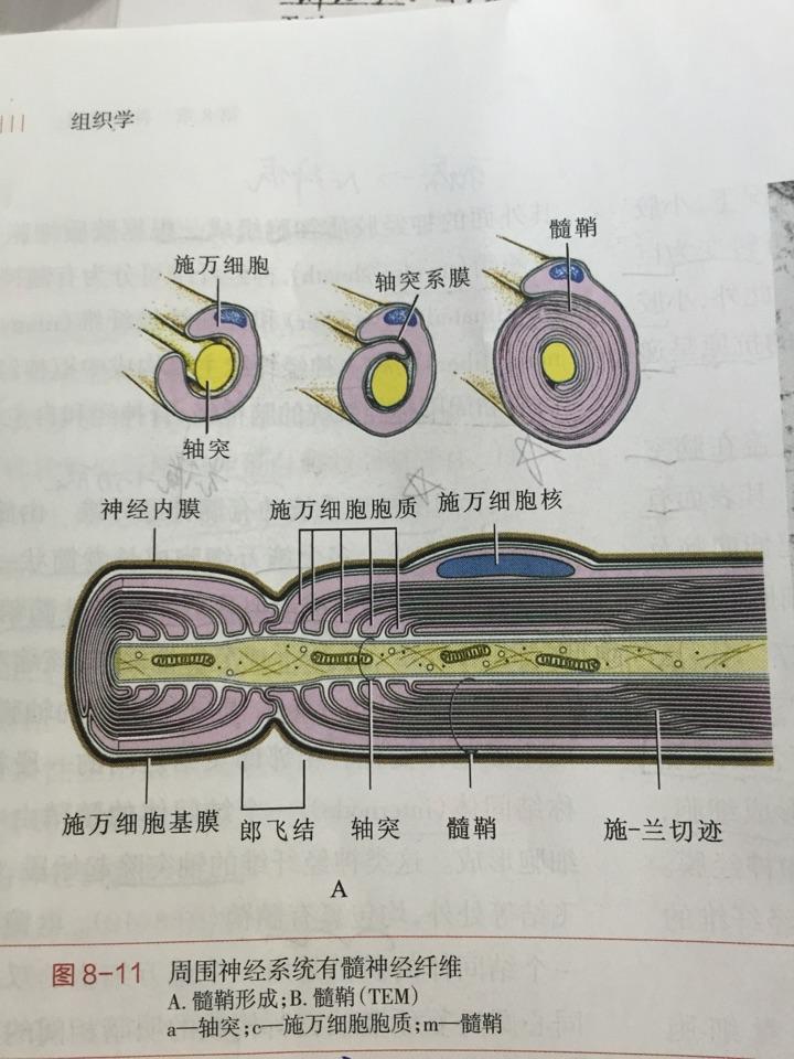 神经膜与神经内膜有什么关系吗都是包裹在神经外有包裹与被包裹的关系