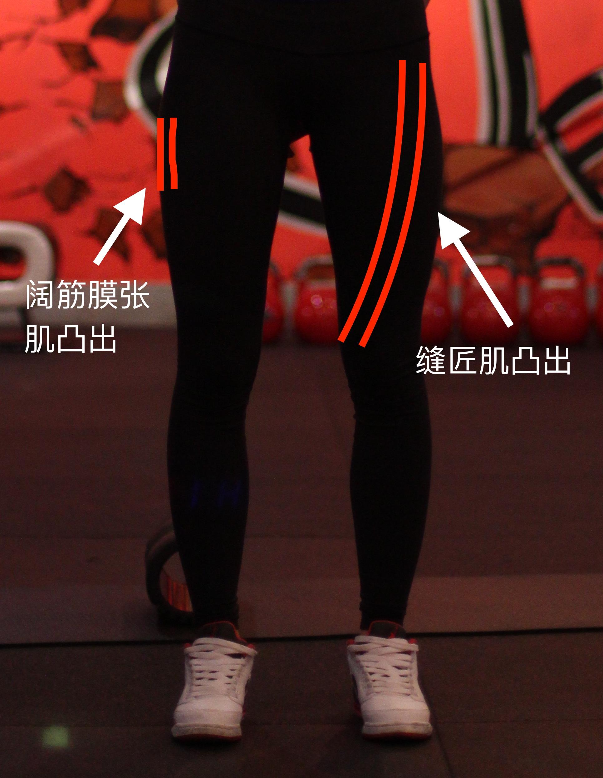 大腿前侧的肌肉过于发达怎么办