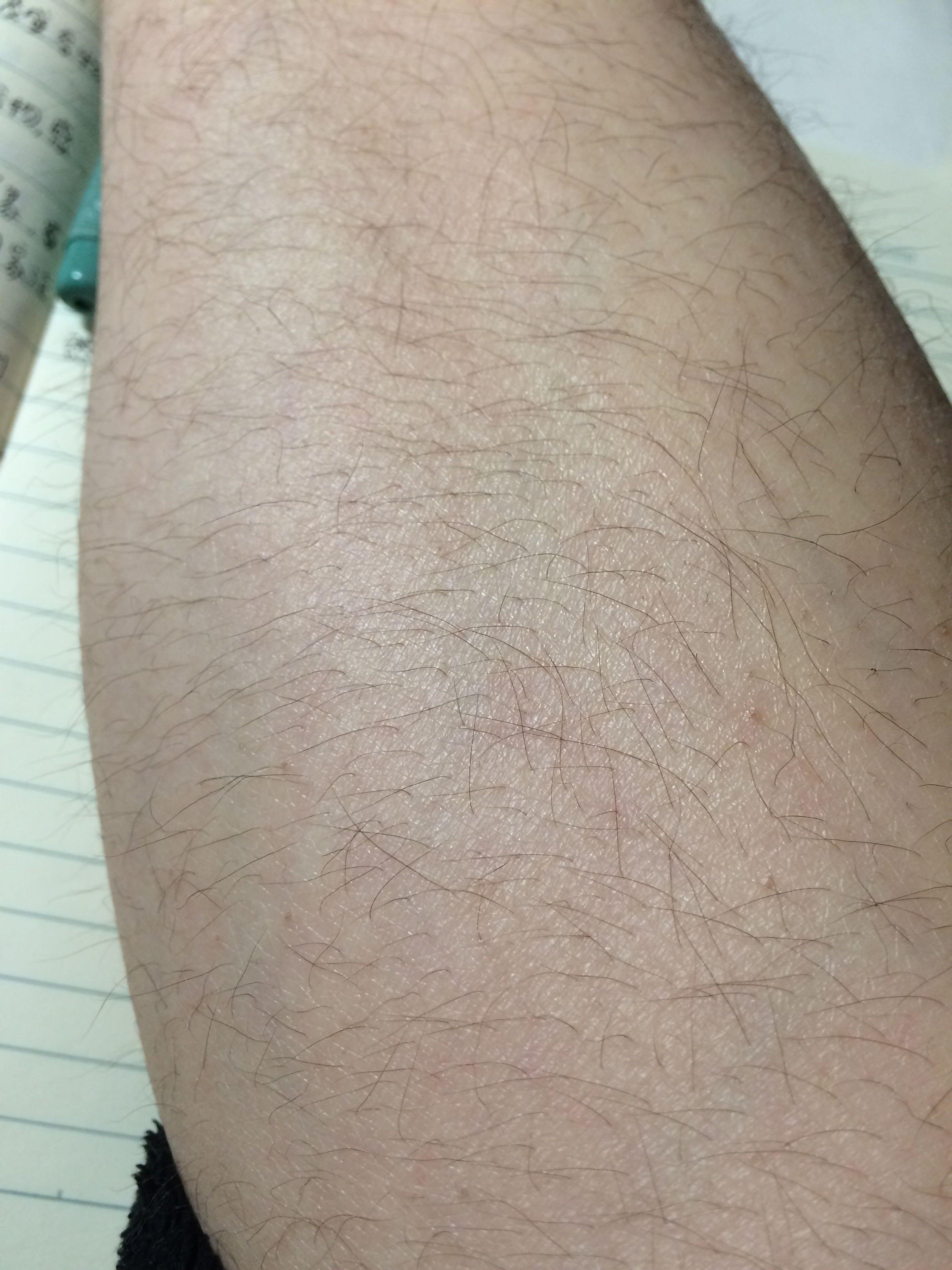 女生腿毛旺盛是怎样的人生体验