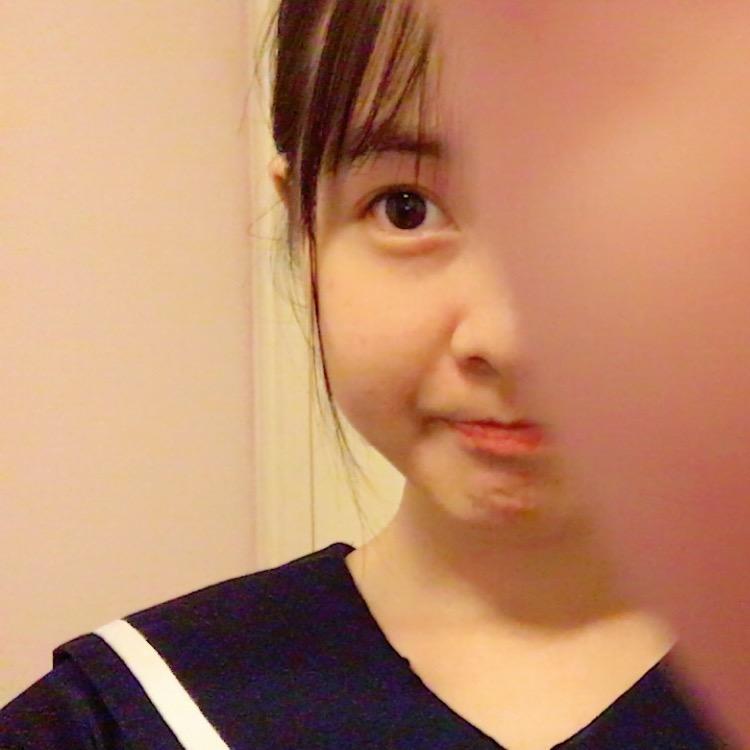 女生有婴儿肥是怎样的一种体验