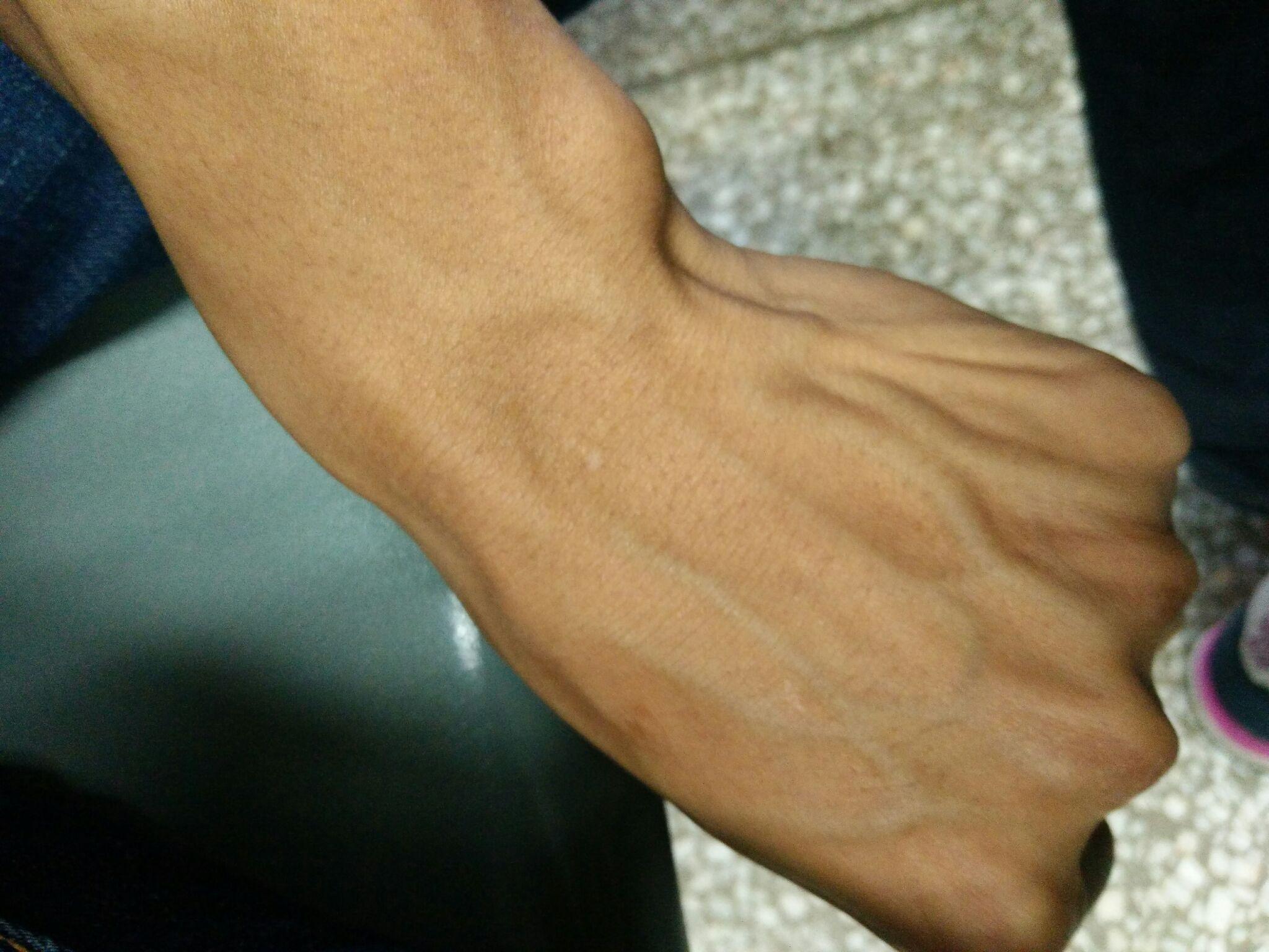 为什么我的手背上静脉血管那么明显?如何改善? - 知乎