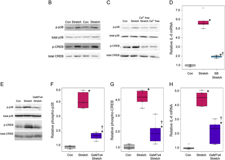 膜上皮細胞中機械感受器 Piezo1 通道介導的白細胞介素表達:將機械應力與眼部炎癥聯系起來 膜上皮細胞中機械感受器 Piezo1 通道介導的白細胞介素表達:將機械應力與眼部炎癥聯系起來