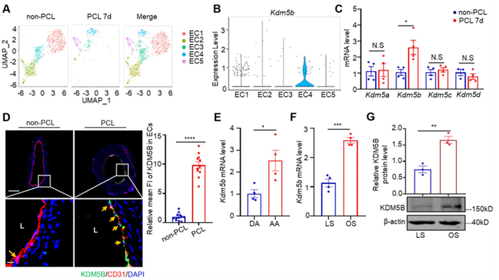 Piezo1 調(diào)控的內(nèi)皮 KDM5B 參與紊亂血流誘導(dǎo)的動(dòng)脈粥樣硬化斑塊形成
