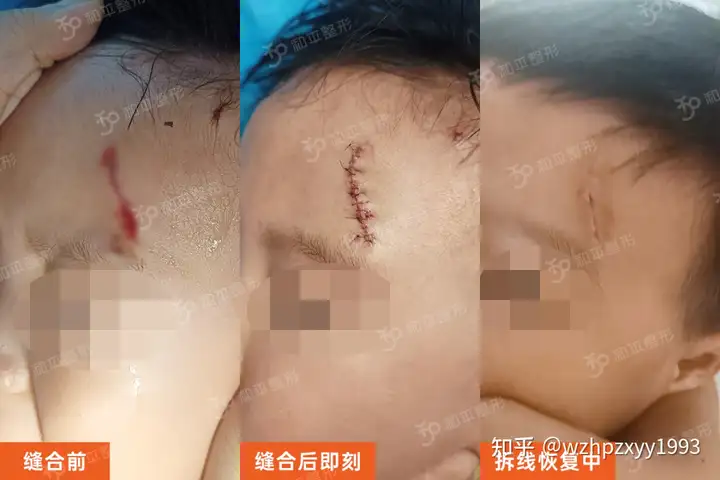事发温州!一家长深夜驱车3小时,只为孩子这件事