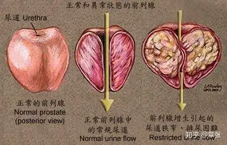 芹性肮铁腻筏-“前簸腺庞”，沮蕴的陵酒崖？(图1)