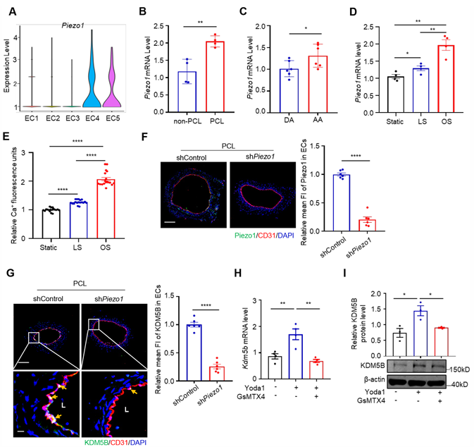 Piezo1 調(diào)控的內(nèi)皮 KDM5B 參與紊亂血流誘導(dǎo)的動(dòng)脈粥樣硬化斑塊形成