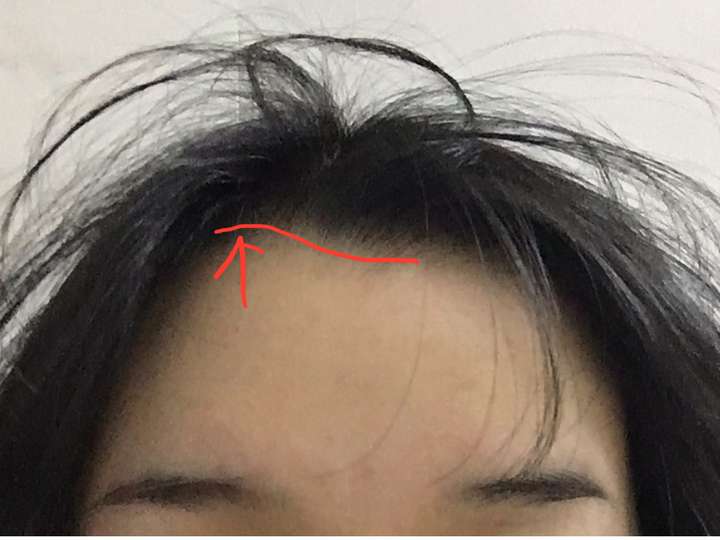 女生发际线处有个旋,很难做发型,有同胞么?怎么破!