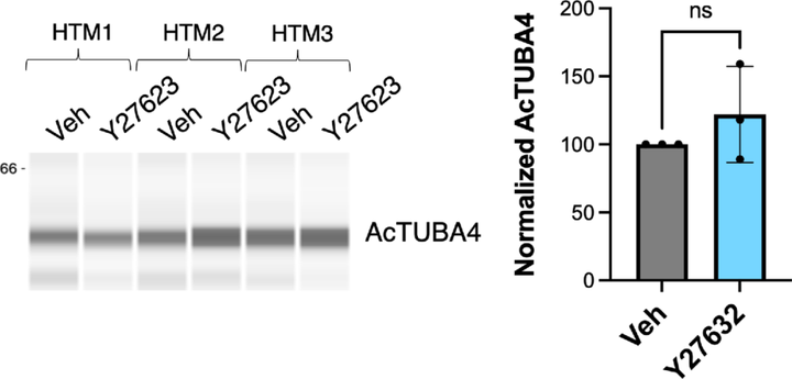 微管蛋白乙酰化增強機械應力下小梁網細胞的微管穩定性