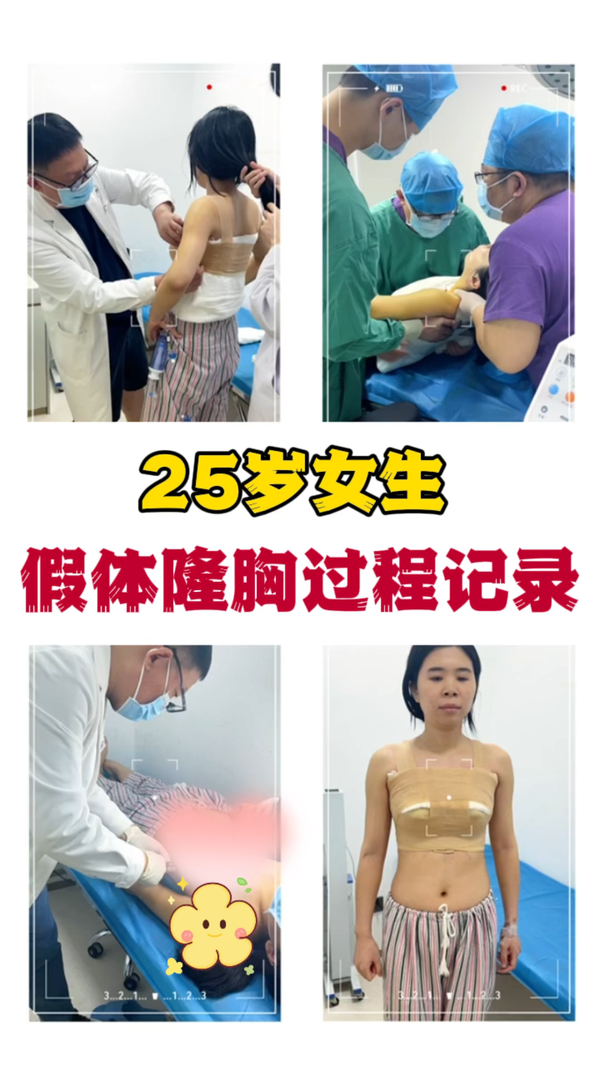 从手术当天术前画线到术后第二天,术后第三天全过程记录分享