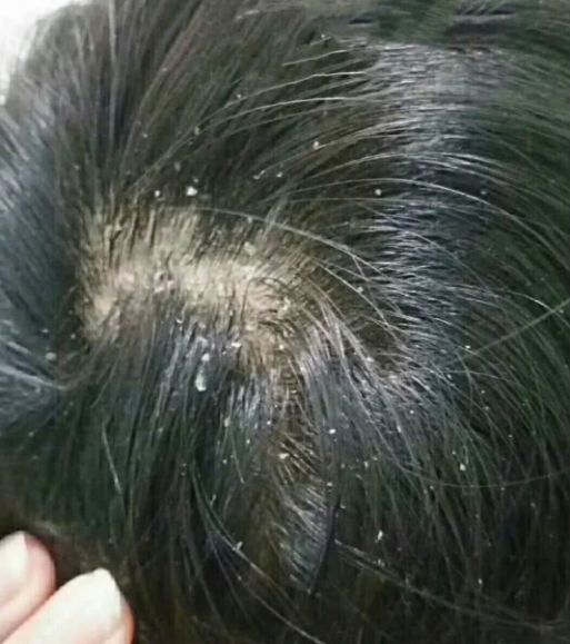 平时家里的吹风机可以选择好一点的,比如戴森吹风机,能够快速吹干头发