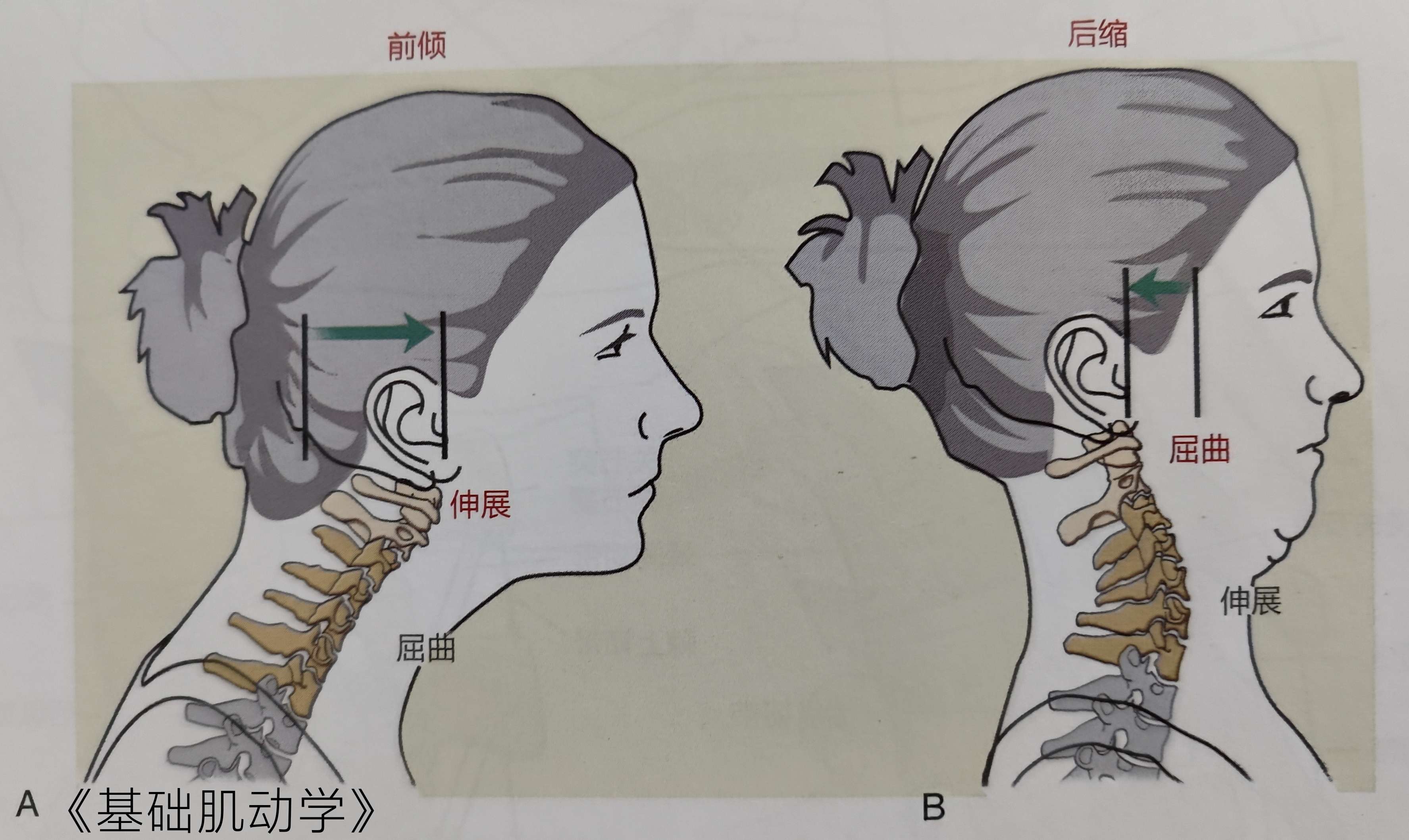 sam 的想法: 头部前倾姿势的治疗 | 头部前倾是头颈段… - 知乎