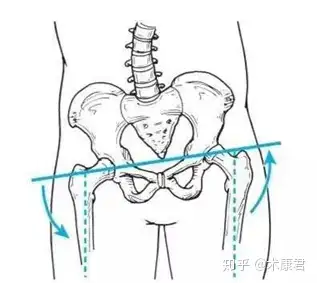 骨盆右旋会为什么会导致右侧腘绳肌紧张? - 知乎