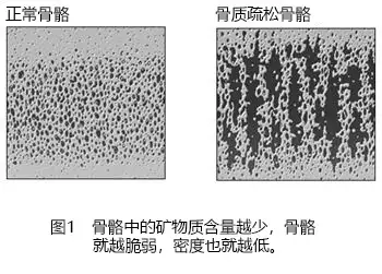 骨起薪十症（上）(图1)