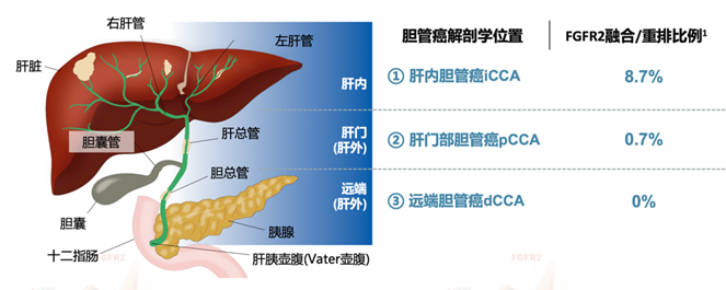 胆管癌治疗破冰：FGFR抑制剂佩米替尼开启精准治疗之门