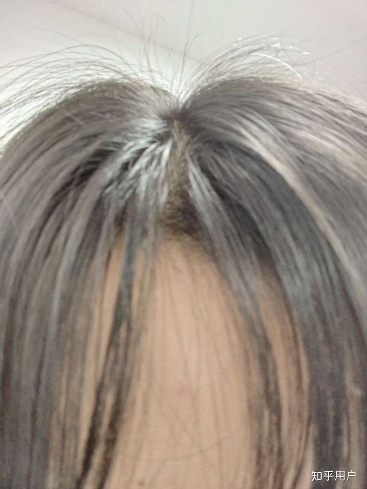 女生发际线处有个旋,很难做发型,有同胞么?怎么破!