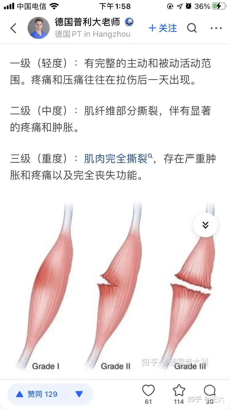 如何看待篮网淘汰后詹姆斯哈登一直说伤病，强调自己二级拉伤？这和詹皇